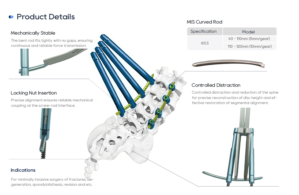 MisFix 5.5 Components: Coaxial Pedicle Screw, Polyaxial Screw, Curved Rod, and Locking Nut MisFix 5.5-Komponenten: Koaxiale Pedikelschraube, Polyaxialschraube, gebogener Stab und Sicherungsmutter