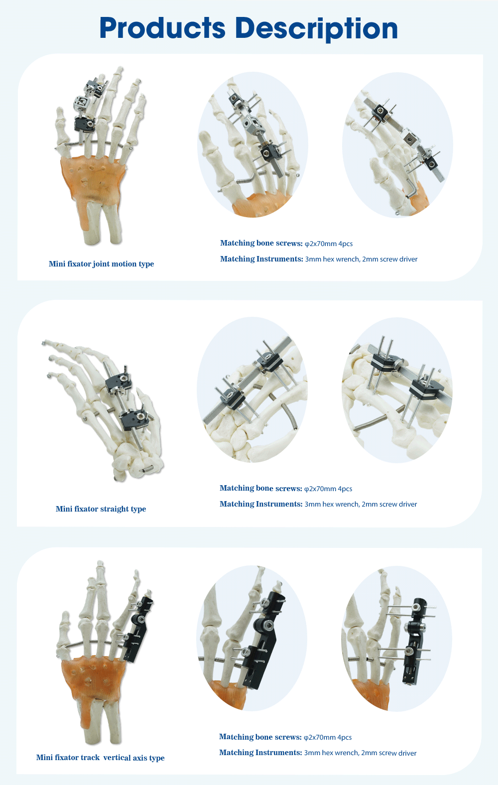 External Fixation Ntawm Metacarpals Thiab Phalanges - Duab 3