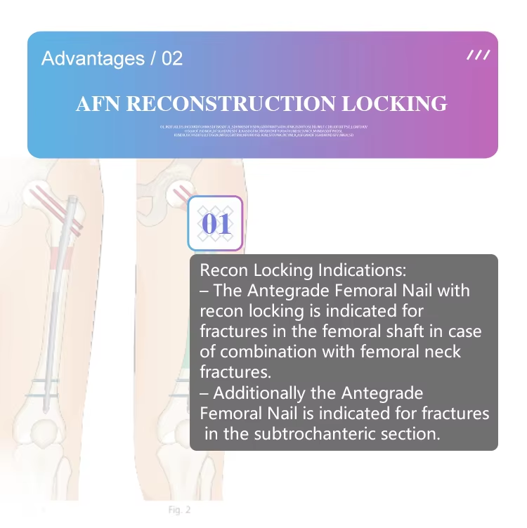 At&oacute;g&aacute;il Femoral Intramedullary ingne-3