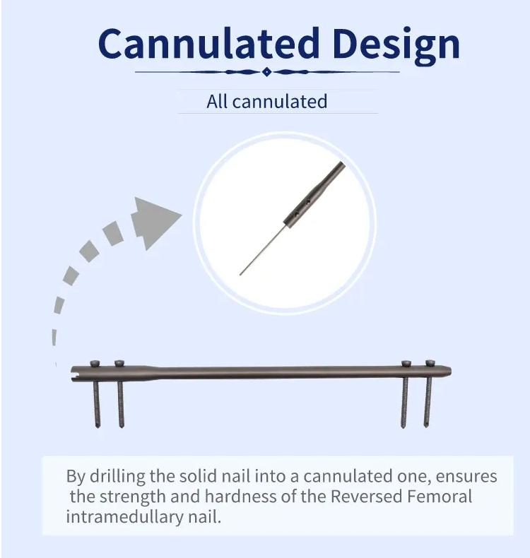 Kusinthidwa kwa Femoral Intramedullary Nail-4