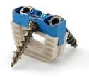 0 Profil cervical Cage-II