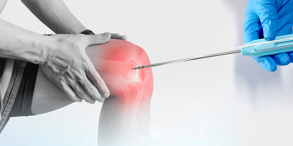 Heleuma Suture Titanium | Hoʻopili Hoʻoponopono Ligament no ka poʻohiwi a me ke kuli | XC Medico