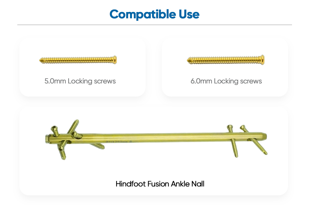 Набор інструментаў Hindfoot Fusion Ankle Nail - купляйце прадукт на XC Medico