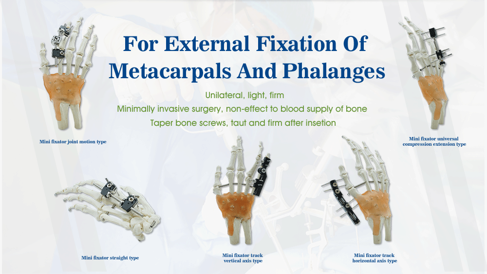 External Fixation Ntawm Metacarpals Thiab Phalanges - Duab 2