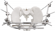 Pelvic Combinational fixator
