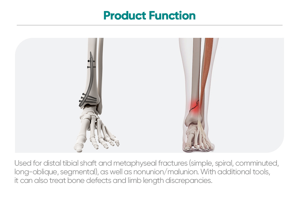 Retrograd Tibial Nail Instrument S&aelig;t | Distal Tibia Fracture Fixation Kit | XC Medico