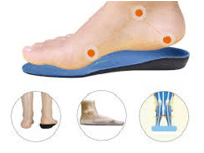 How to Treat and Prevent Flat Feet?
