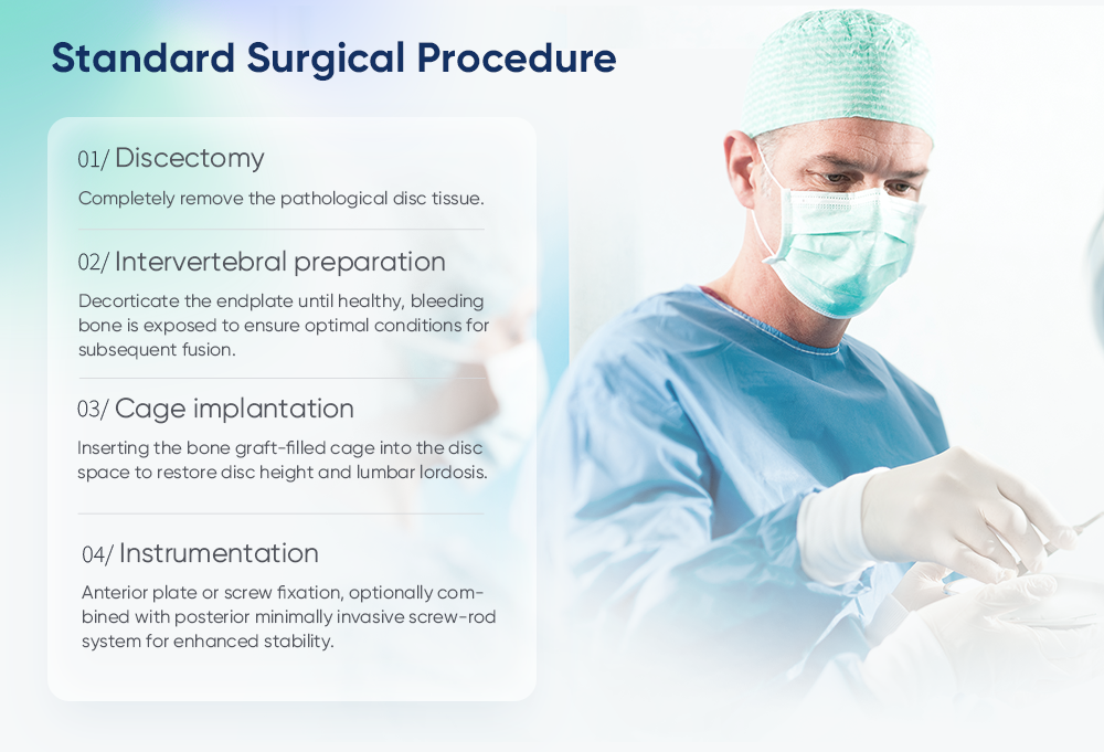 Nidaamka Qafiska ALIF | Gudaha Lumbar Fusion Implant | XC Medico