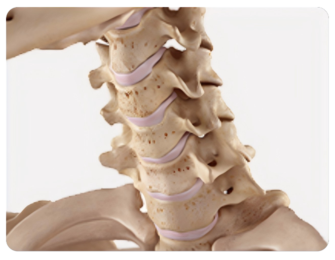 C2manta C7kama columna cervical nisqapi niveles nisqakuna